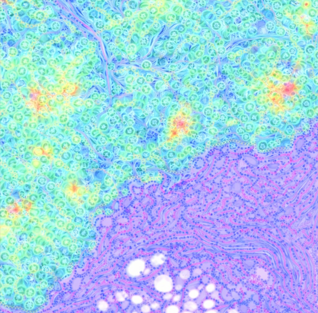 Digital pathology AI visualization