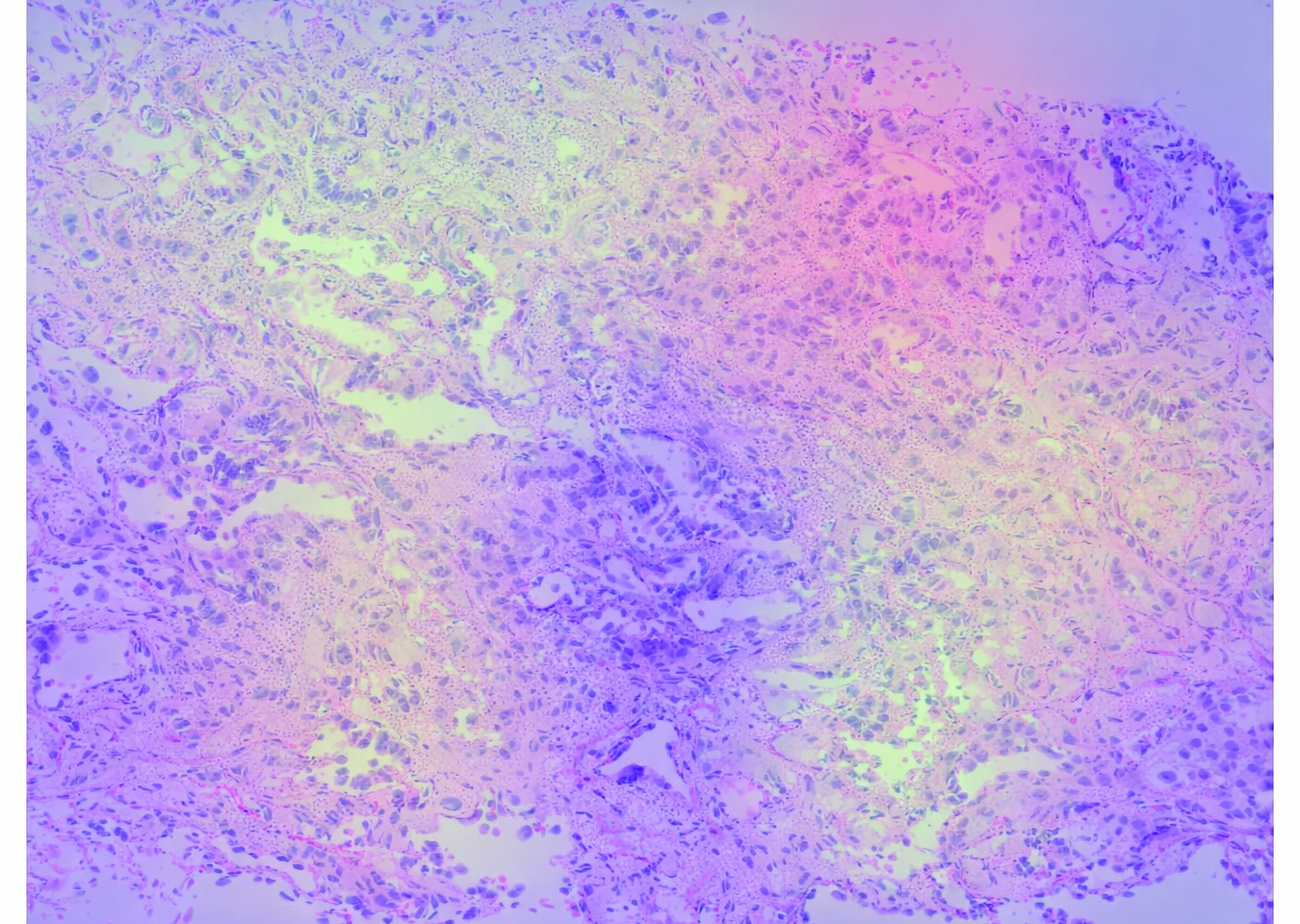 Digital pathology